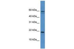 Image no. 1 for anti-Heat Shock 27kDa Protein Family, Member 7 (Cardiovascular) (HSPB7) (AA 51-100) antibody (ABIN6746091) (HSPB7 抗体  (AA 51-100))