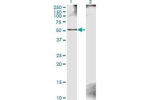 Western Blot analysis of ZWILCH expression in transfected 293T cell line by ZWILCH monoclonal antibody (M11), clone 1C10. (ZWILCH 抗体  (AA 1-477))