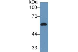 Western Blot; Sample: Rat Plasma; Primary Ab: 2µg/ml Rabbit Anti-Rat DBP Antibody Second Ab: 0. (Vitamin D-Binding Protein 抗体  (AA 209-394))