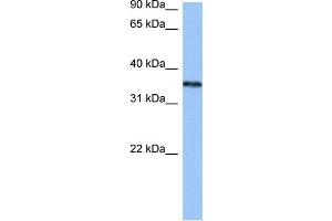 WB Suggested Anti-HNRNPA2B1 Antibody Titration:  0. (HNRNPA2B1 抗体  (N-Term))