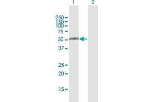 Western Blot analysis of TRIM35 expression in transfected 293T cell line by TRIM35 MaxPab polyclonal antibody. (TRIM35 抗体  (AA 1-493))
