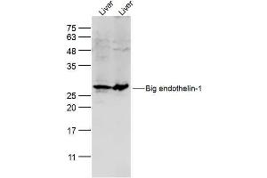 Lane 1: mouse liver lysates Lane 2: rat liver lysates probed with Preproendothelin 1 Polyclonal Antibody, Unconjugated  at 1:300 dilution and 4˚C overnight incubation. (Prepro-Endothelin-1 (AA 16-110) 抗体)