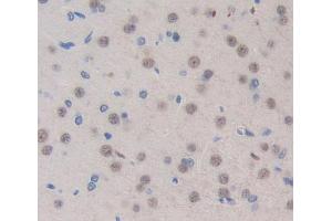 Used in DAB staining on fromalin fixed paraffin- embedded brain tissue (TOPBP1 抗体  (AA 1-246))