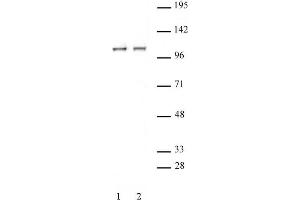 STAT2 antibody (pAb) tested by Immunoprecipitation. (STAT2 抗体  (C-Term))