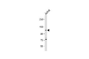 Anti-PKN1 Antibody (C-Term) at 1:2000 dilution + Jurkat whole cell lysate Lysates/proteins at 20 μg per lane. (PKN1 抗体  (AA 836-870))