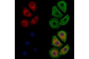 ABIN6261327 and ABIN6278854 staining Hela cells by IF/ICC. (DNAJA1 抗体  (C-Term))