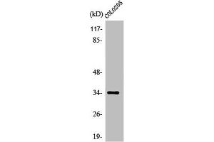 Western Blot analysis of COLO205 cells using Olfactory receptor 5P3 Polyclonal Antibody (OR5P3 抗体  (Internal Region))