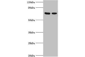 Western blot All lanes: TCTN2 antibody at 10 μg/mL Lane 1: Jurkat whole cell lysate Lane 2: A549 whole cell lysate Secondary Goat polyclonal to rabbit IgG at 1/10000 dilution Predicted band size: 77 kDa Observed band size: 77 kDa