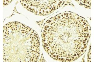 ABIN6269353 at 1/100 staining Mouse testis tissue by IHC-P. (HDAC1 抗体  (C-Term))