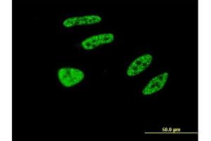 Immunofluorescence (IF) image for anti-Tripartite Motif Containing 32 (TRIM32) (AA 105-204) antibody (ABIN524889)