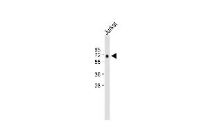 Anti-RUNX2 Antibody at 1:2000 dilution + Jurkat whole cell lysate Lysates/proteins at 20 μg per lane. (RUNX2 抗体  (AA 445-474))