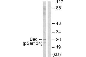 Immunohistochemistry analysis of paraffin-embedded human brain tissue using BAD (Phospho-Ser134) antibody. (BAD 抗体  (pSer134))