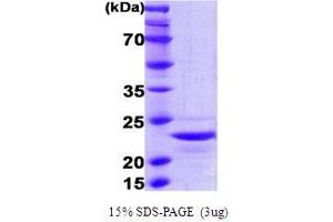 SDS-PAGE (SDS) image for Interleukin 1 alpha (IL1A) (AA 113-271) protein (His tag) (ABIN5855196)