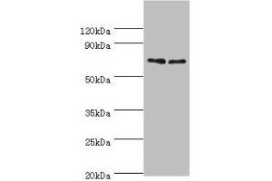 Western Blotting (WB) image for anti-Tumor Necrosis Factor Receptor Superfamily, Member 21 (TNFRSF21) (AA 371-655) antibody (ABIN7173876)