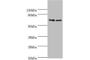 Western blot All lanes: TNFRSF21 antibody at 4 μg/mL Lane 1: K562 whole cell lysate Lane 2: Jurkat whole cell lysate Secondary Goat polyclonal to rabbit IgG at 1/10000 dilution Predicted band size: 72 kDa Observed band size: 72 kDa (TNFRSF21 抗体  (AA 371-655))