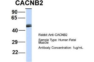 Host:  Rabbit  Target Name:  CACNB2  Sample Type:  Human Fetal Muscle  Antibody Dilution:  1. (CACNB4 抗体  (Middle Region))