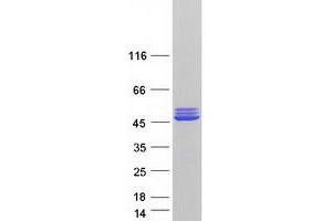 Western Blotting (WB) image for Creatine Kinase, Mitochondrial 2 (Sarcomeric) (CKMT2) (Transcript Variant 3) protein (Myc-DYKDDDDK Tag) (ABIN2712841)