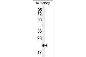 GPX3 Antibody (Center) (ABIN650617 and ABIN2844787) western blot analysis in mouse kidney tissue lysates (35 μg/lane). (GPX3 抗体  (AA 93-123))