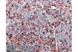 Immunohistochemistry (IHC) image for anti-Nuclear Factor of Activated T-Cells, Cytoplasmic, Calcineurin-Dependent 2 (NFAT1) (Internal Region) antibody (ABIN571020)
