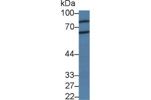 Western blot analysis of Rat Cerebrum lysate, using Human PADI2 Antibody (3 µg/ml) and HRP-conjugated Goat Anti-Rabbit antibody (