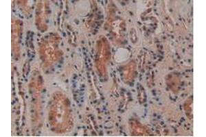 IHC-P analysis of Human Kidney Tissue, with DAB staining. (Osteopontin 抗体  (AA 17-287))