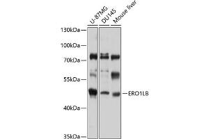 Western blot analysis of extracts of various cell lines, using ERO1LB antibody (ABIN6132192, ABIN6140294, ABIN6140295 and ABIN6220326) at 1:1000 dilution. (ERO1LB 抗体  (AA 34-230))