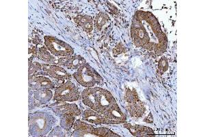 IHC analysis of MFF using anti-MFF antibody (ABIN7599292). (MFF 抗体  (AA 1-342))