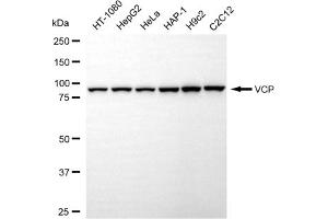 Western blotting analysis using VCP antibody (ABIN7800820).