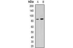 Western blot analysis of RPGR expression in Y79 (A), mouse heart (B) whole cell lysates. (RPGR 抗体)