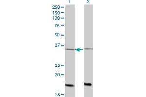Western Blot analysis of ADCK4 expression in transfected 293T cell line by ADCK4 monoclonal antibody (M01), clone 1D9. (ADCK4 抗体  (AA 445-544))