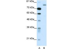WB Suggested Anti-TRIM28 Antibody Titration:  1. (KAP1 抗体  (C-Term))