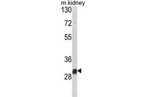 Western blot analysis of NAT2 Antibody (C-term) in mouse kidney tissue lysates (35ug/lane). (NAT2 抗体  (C-Term))