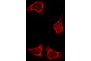 ABIN6275883 staining HeLa by IF/ICC. (IL4I1 抗体  (N-Term))