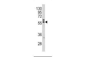 Western blot analysis of MAPE antibody in K562 cell line lysates (35ug/lane) (PRAME 抗体  (C-Term))