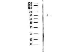 Western blot analysis of lysates from MC-3-E1 cells, using PIP4K2C Antibody at 1/1000 dilution.