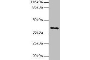 Western blot All lanes: MAGEA10 antibody at 2 μg/mL + HL60 whole cell lysate Secondary Goat polyclonal to rabbit IgG at 1/10000 dilution Predicted band size: 41 kDa Observed band size: 41 kDa (MAGEA1 抗体  (AA 2-225))