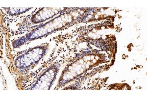 Detection of S100A6 in Porcine Colon Tissue using Polyclonal Antibody to S100 Calcium Binding Protein A6 (S100A6)