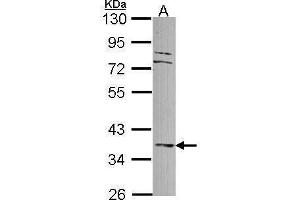 WB Image Sample (30 ug of whole cell lysate) A: A549 10% SDS PAGE antibody diluted at 1:1000 (DUSP6 抗体)