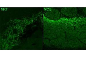 Immunohistochemistry (IHC) image for anti-gamma-aminobutyric Acid (GABA) A Receptor, alpha 3 (GABRA3) (AA 29-43) antibody (ABIN1742460)