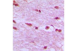 Immunohistochemical analysis of Lamin B1 staining in human brain formalin fixed paraffin embedded tissue section. (Lamin B1 抗体  (N-Term))