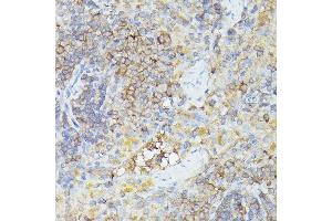 Immunohistochemistry (IHC) image for anti-Chemokine (C-X3-C Motif) Ligand 1 (CX3CL1) (AA 365-397) antibody (ABIN6139265)