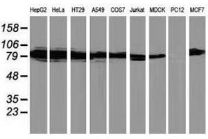 Image no. 2 for anti-Protein Kinase C, epsilon (PRKCE) antibody (ABIN1500229) (PKC epsilon 抗体)