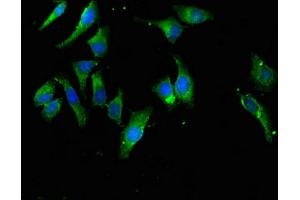 Immunofluorescent analysis of Hela cells using ABIN7152180 at dilution of 1:100 and Alexa Fluor 488-congugated AffiniPure Goat Anti-Rabbit IgG(H+L) (EIF4B 抗体  (AA 362-590))