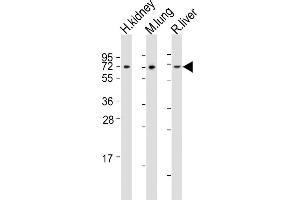 All lanes : Anti-ACSF2 Antibody (Center) at 1:2000 dilution Lane 1: human kidney lysates Lane 2: mouse lung lysates Lane 3: rat liver lysates Lysates/proteins at 20 μg per lane. (ACSF2 抗体  (AA 198-232))