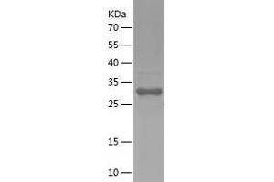 Western Blotting (WB) image for CD59 (CD59) (AA 26-102) protein (His-IF2DI Tag) (ABIN7122212) (CD59 Protein (CD59) (AA 26-102) (His-IF2DI Tag))