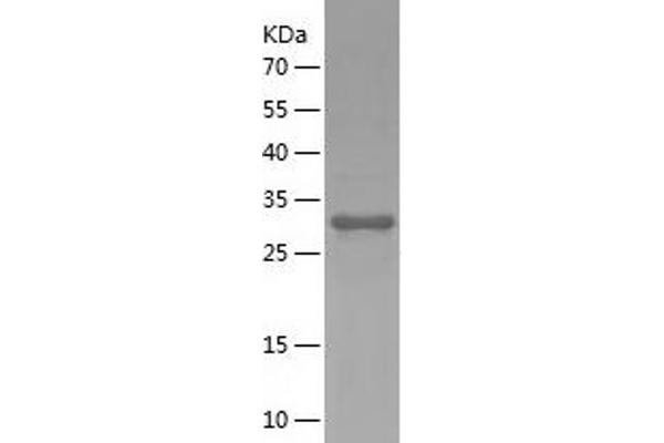 CD59 Protein (CD59) (AA 26-102) (His-IF2DI Tag)