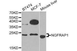 Western blot analysis of extracts of various cell lines, using NGFRAP1 Antibody (ABIN5974398) at 1/1000 dilution. (Nerve Growth Factor Receptor (TNFRSF16) Associated Protein 1 (NGFRAP1) 抗体)