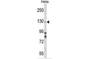 Western blot analysis of ITGA1 Antibody (Center) in Hela cell line lysates (35ug/lane). (Integrin alpha 1 抗体  (Middle Region))