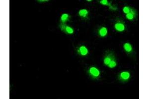 Immunofluorescence (IF) image for anti-Solute Carrier Family 2 (Facilitated Glucose/fructose Transporter), Member 5 (SLC2A5) antibody (ABIN1498475) (SLC2A5 抗体)
