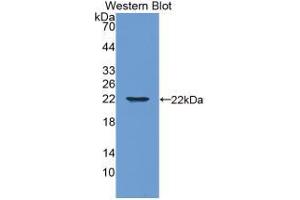 Western blot analysis of the recombinant protein. (Aggrecan 抗体  (AA 34-147))